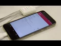 Cardions Mobile ECG