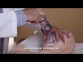 The Dechoker Anti-Choking Device