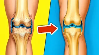 The BEST Foods to REGENERATE Knee Cartilage 💥 (Super Fast) 🤯