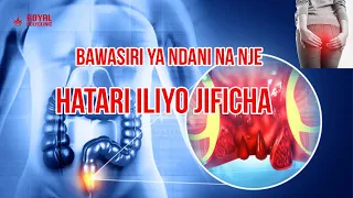 bawasiri damu maumivu na aibu usipochukua hatua sasa