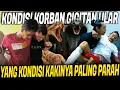 Lagu DUA KORBAN GIGITAN ULAR INI SELAMAT DARI MAUT!! PANJI TOLONG PAKE CARA INI