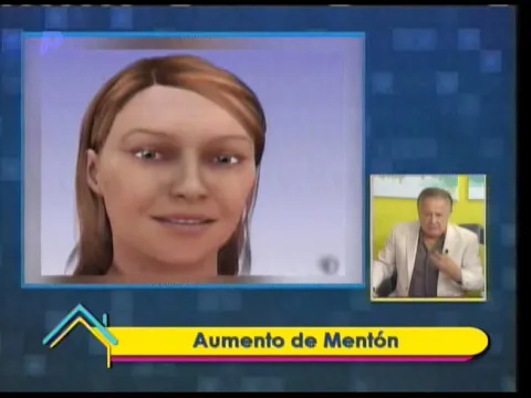 Estética al Día: Aumento de mentón 