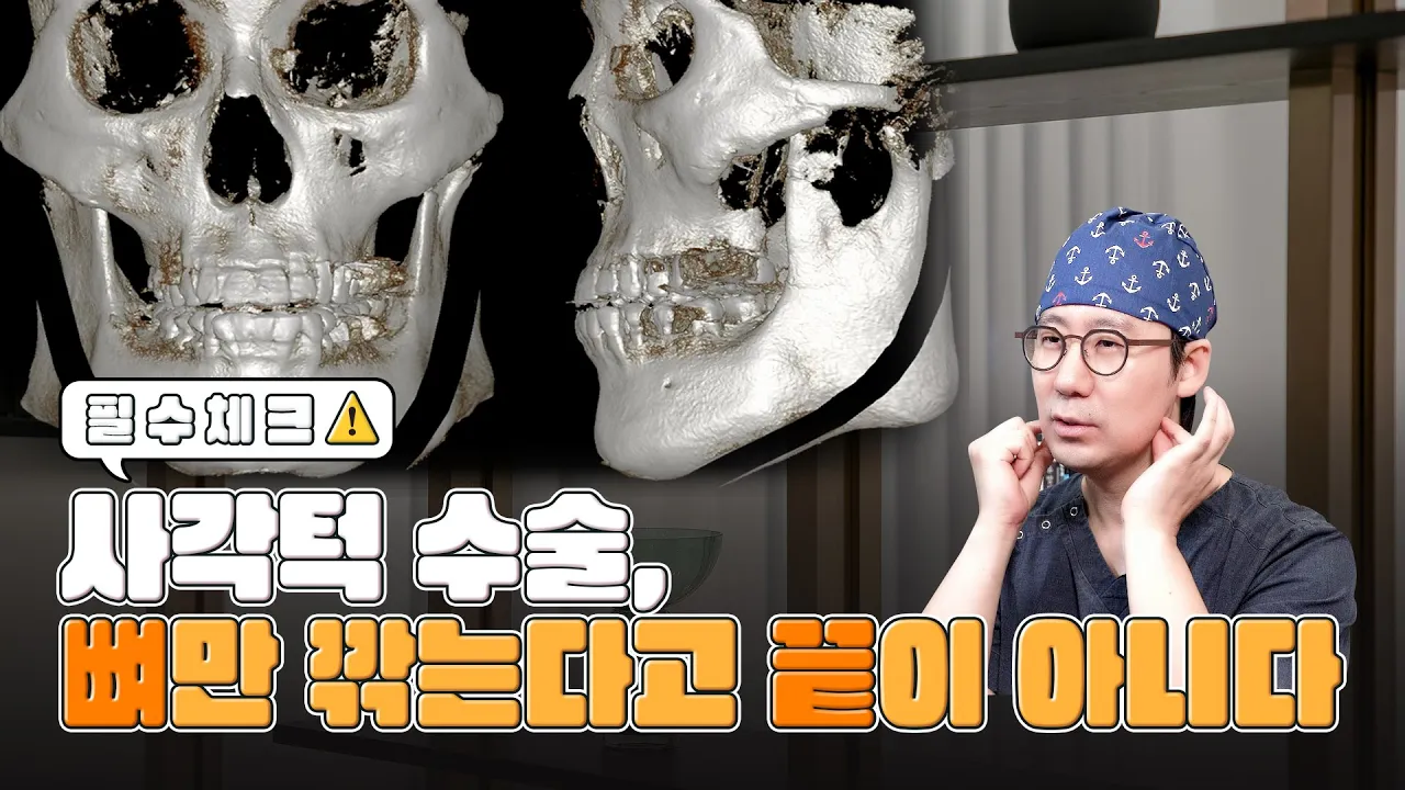 필수체크⚠️ 사각턱 수술, 뼈만 깎는다고 끝이 아니다
