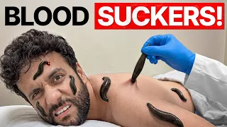 20 Deadly Leeches vs My Body! (Crazy Experiment)