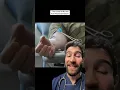 Scarring from Plasma Donation Doctor Explains