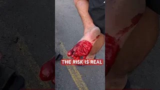 BAREFOOT FAIL : NOT FOR THE INEXPERIENCED 😂