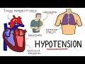 Causes of Hypotension - What causes Low Blood Pressure with Signs and Symptoms