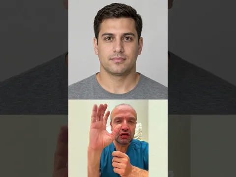 كيف يؤثر التستوستيرون على وجه الرجل