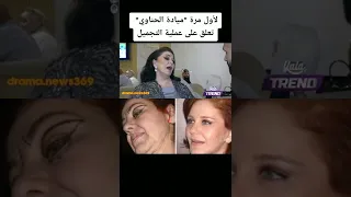 لأول مرة ميادة الحناوي تعلق على عملية التجميل 