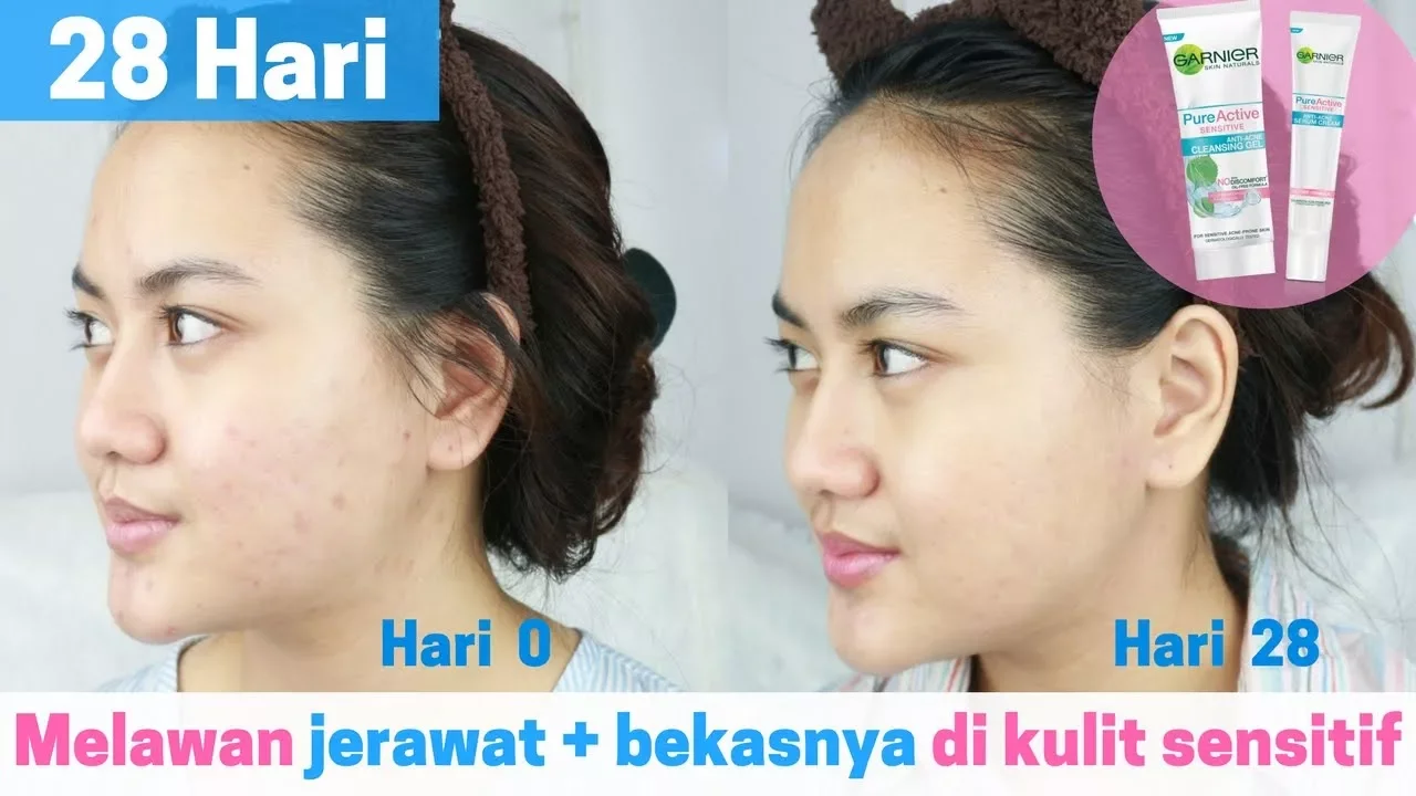 Daun sereh obat tradisional syaraf kejepit di pinggang dioles atau di boreh di bagian yg sakit di vi. 