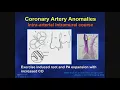Adult Congenital Heart Disease Anomalous Coronary Arteries Risk Stratification
