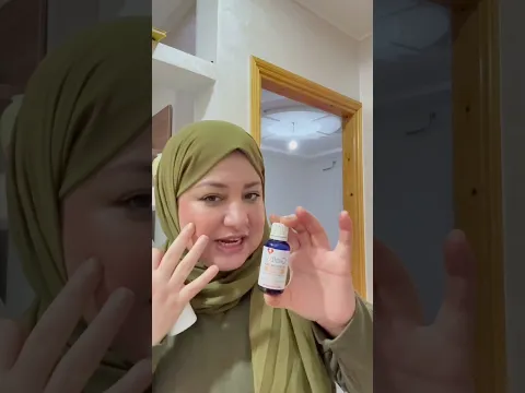 أقوى تحدي ازالة الكلف😰