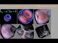 The 3D wave equation using Finite Difference python