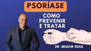 PSORÍASE: Como Prevenir e Tratar || Dr. Moacir Rosa