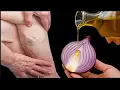 Download Lagu Beenpijn. Reuma, spataderen, krampen, artritis, gewrichtspijn. In 3 dagen. Deze plant.