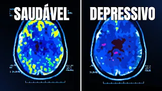 COMO é o CÉREBRO de quem tem DEPRESSÃO?