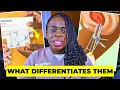 Different Types of Abortion Explained Medical Surgical