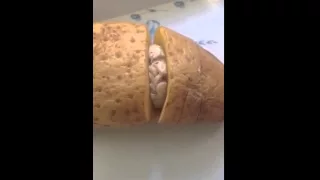 مواطن في عفيف يعثر على حبوب كبتاجون المخدرة في بطاطس  رسالة الدوادمي  دندنها