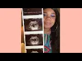 Download Lagu Did Conceive Plus get me pregnant?!