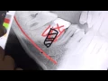 Immediate dental implant after extracting infected tooth - Dr German Arzate DDS