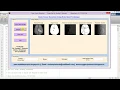 Matlab Code for Brain Tumor Detection Using Watershed Technique