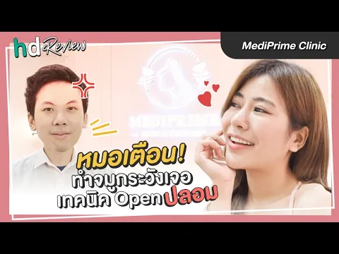 รีวิวทำจมูก แก้จมูกครั้งที่ 3 เทคนิค Open ที่ MediPrime Clinic