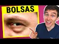 Download Lagu Optometrista Explica Cómo Deshacerse de las Bolsas en los Ojos
