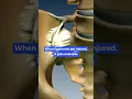 Stabilizing the SI Joint prevents inflammation