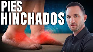 ¿Tienes los pies hinchados? puede ser MORTAL Y NO LO SABIAS #retenciondeliquidos