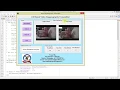Steganography Matlab Project with Source Code