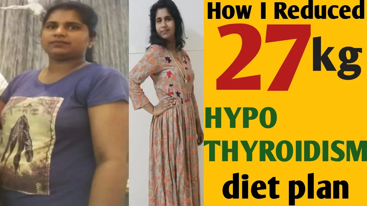 Hypothyroidism weight loss diet ഹൈപ്പോതൈറോയ്ഡിസം ഡയറ്റ്weightloss journey and tips exercise and diet