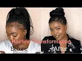 How to hide your thin hairline when you have braids l Hairline Transformation l SouthAfricanYoutuber
