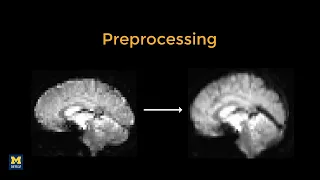 SPM Tutorial - a Introduction to Preprocessing