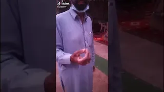 لاستخراج الشوك من القدم 