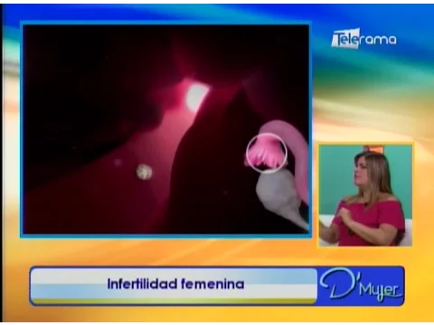 Infertilidad femenina