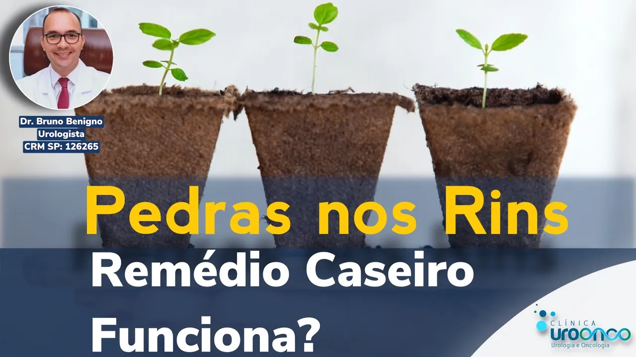 Como eliminar pedras na bexiga ou no rim?