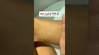 اگه حوصله موهایه زیر پوستی بد شیو رونداری ببین  اگه حوصله موهایه زیر پوستی بد شیو رونداری ببین