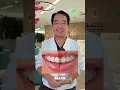 There are 5 main types of braces