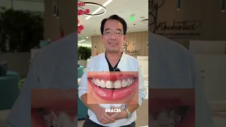There are 5 main types of braces