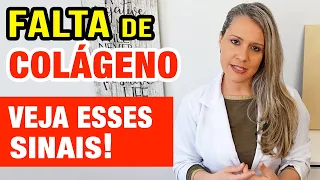 Sinais de FALTA de COLÁGENO - Seu corpo está sofrendo e quer te avisar