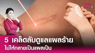  วิธีดูแลแผลให้ไม่เกิดแผลเป็นมีอะไรบ้าง 