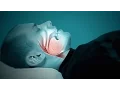 Download Lagu Sleep Apnea