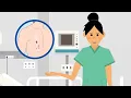 Evaluate Using Hand Hygiene Data for Action
