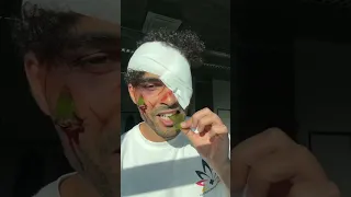 So To Answer Your Question It Didn T Hurt But Please Don T Try It At Home 