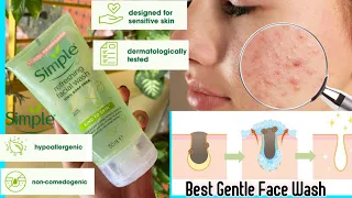 simple refreshing Facewash Full review Simple kind to skin face wash best face wash for sensitive