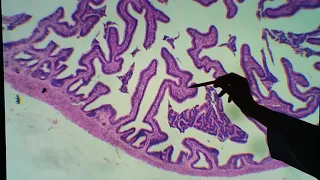 Histologia da tuba uterina