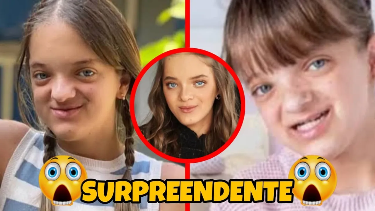 Rafaella Justus fez harmonização facial? Qual foi o procedimento e o antes e depois da cirurgia