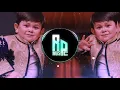 Download Lagu Abdu Rozik - Ohi Dili Zor (Rodrigo Pro Remix) MEU NOME É TONIN