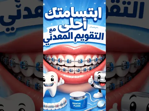 كل ما تريد معرفته عن التقويم المعدني! | Smile Expertez Clinics