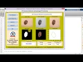 Skin Cancer Detection using matlab